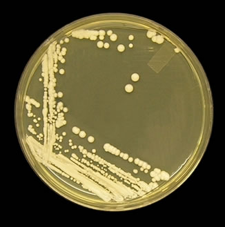 Coprocultura com crescimento de Candida albicans