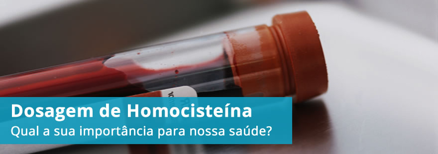 Exame de Homocisteína: quando está alta, importância e valores de referência